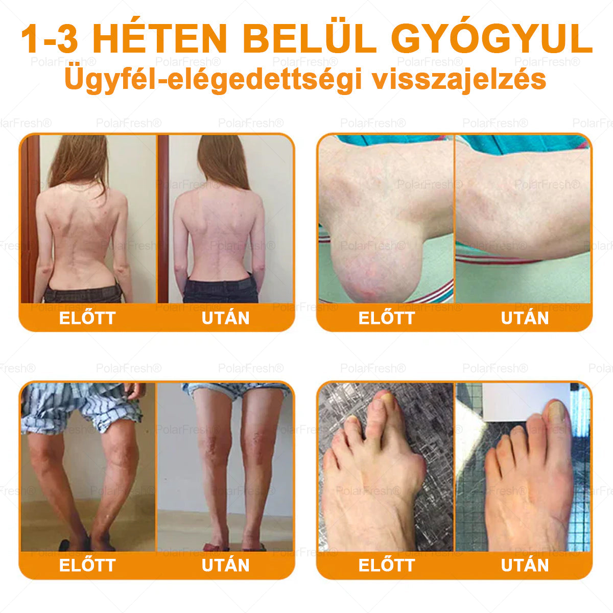 💧🐝PolarFresh® Magnézium Olaj & Méhméreg Fájdalomcsillapító, Csontregeneráló Krém 👨⚕️Jóváhagyta a Magyar Ortopéd Sebészek Akadémiája (Magyar Ortopédiai Sebésztársaság – MOSZT)