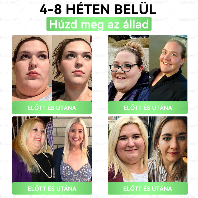 👑Hivatalos áruház | BuildLeaf GLP-1 20 az 1-ben Karcsúsító és egészséges szájon át szedhető folyadék (naponta egyszer, 7 napon belül hat) ✅ Támogatja a testsúlyt és a nők egészségét, miközben feszesíti a bőrt és fokozza a vitalitást