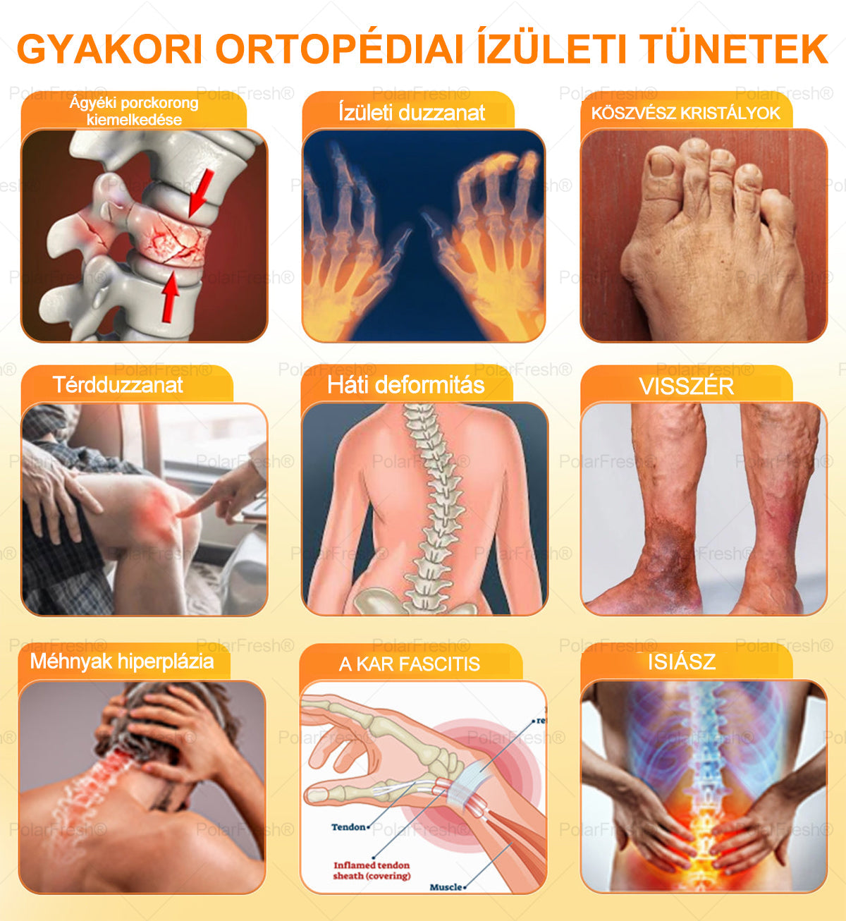 💧🐝PolarFresh® Magnézium Olaj & Méhméreg Fájdalomcsillapító, Csontregeneráló Krém 👨‍⚕️Jóváhagyta a Magyar Ortopéd Sebészek Akadémiája (Magyar Ortopédiai Sebésztársaság – MOSZT)
