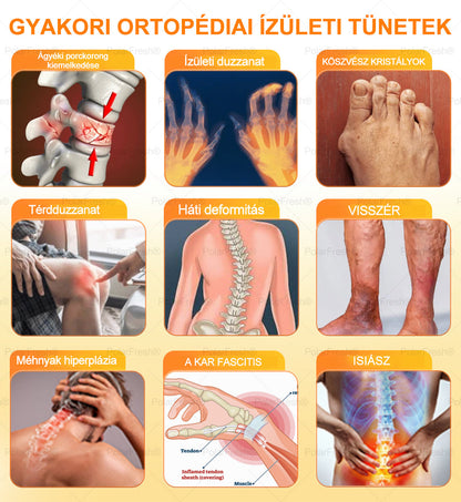 💧🐝PolarFresh® Magnézium Olaj & Méhméreg Fájdalomcsillapító, Csontregeneráló Krém 👨‍⚕️Jóváhagyta a Magyar Ortopéd Sebészek Akadémiája (Magyar Ortopédiai Sebésztársaság – MOSZT)