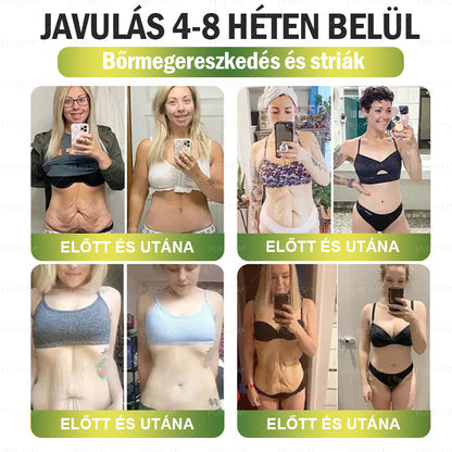 🏆Hivatalos áruház | CrazyLeaf® SMGT-GLP-1 nano tapasz kollagénnel & Matrixyl 3000-rel – Célzott hatás: elhízás,cukorbetegség,bőrmegereszkedés,  zsírmáj,  magas vérnyomás, energiaszint-csökkenés