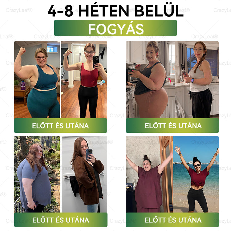🏆Hivatalos áruház | CrazyLeaf® SMGT-GLP-1 nano tapasz kollagénnel & Matrixyl 3000-rel – Célzott hatás: elhízás,cukorbetegség,bőrmegereszkedés,  zsírmáj,  magas vérnyomás, energiaszint-csökkenés