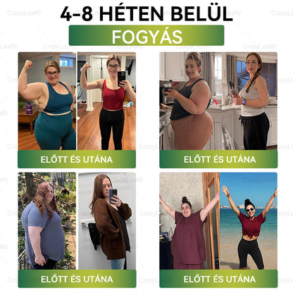 🏆Hivatalos áruház | CrazyLeaf® SMGT-GLP-1 nano tapasz kollagénnel & Matrixyl 3000-rel – Célzott hatás: elhízás,cukorbetegség,bőrmegereszkedés,  zsírmáj,  magas vérnyomás, energiaszint-csökkenés