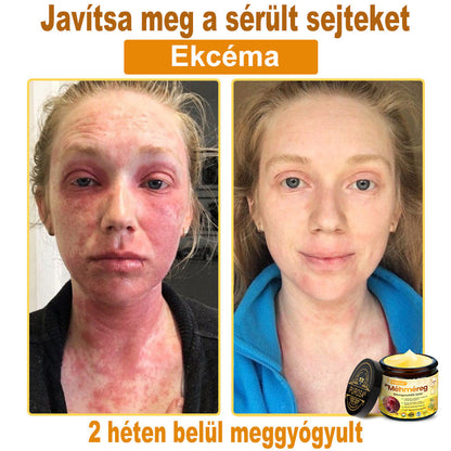 Utolsó nap! Már csak 5 tégely maradt a PUROSA® szuper kedvezményes ajánlatából! Most extra 50% kedvezménnyel teheted meg az első lépést a feszesebb és fiatalosabb bőr felé.