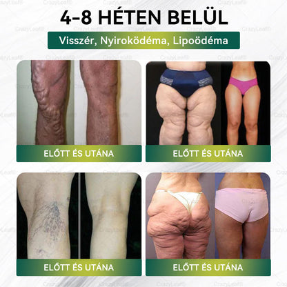 🏆Hivatalos áruház | CrazyLeaf® SMGT-GLP-1 nano tapasz kollagénnel & Matrixyl 3000-rel – Célzott hatás: elhízás,cukorbetegség,bőrmegereszkedés,  zsírmáj,  magas vérnyomás, energiaszint-csökkenés