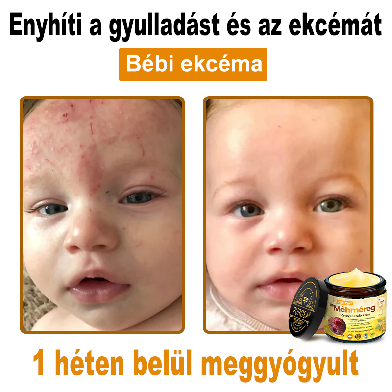 Utolsó nap! Már csak 5 tégely maradt a PUROSA® szuper kedvezményes ajánlatából! Most extra 50% kedvezménnyel teheted meg az első lépést a feszesebb és fiatalosabb bőr felé.