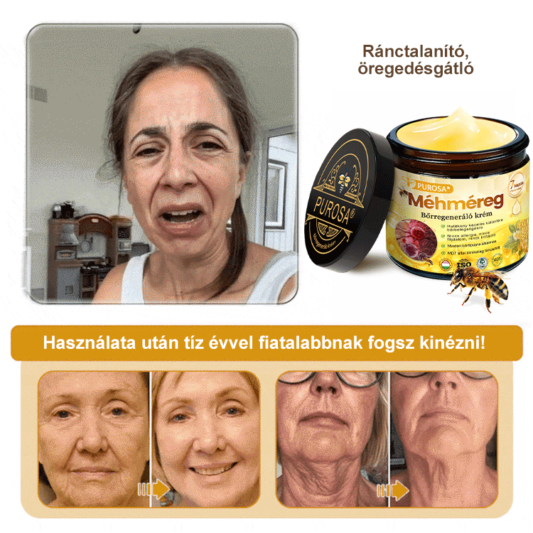 Utolsó nap! Már csak 5 tégely maradt a PUROSA® szuper kedvezményes ajánlatából! Most extra 50% kedvezménnyel teheted meg az első lépést a feszesebb és fiatalosabb bőr felé.