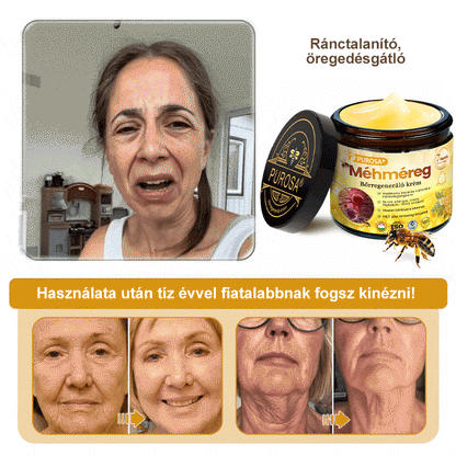 Utolsó nap! Már csak 5 tégely maradt a PUROSA® szuper kedvezményes ajánlatából! Most extra 50% kedvezménnyel teheted meg az első lépést a feszesebb és fiatalosabb bőr felé.