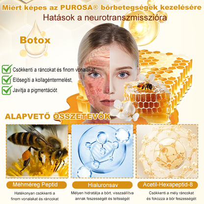 🐝PUROSA® Méhméreg Bőrmegújító Krém｜Teljes körű megoldás a makacs bőrproblémák, például az öregedés, ekcéma, hegek és pikkelysömör ellen