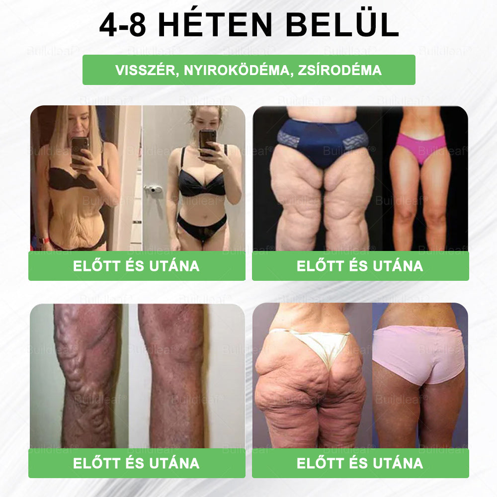 🎁Már csak 5 doboz maradt! BuildLeaf® – Most akár 50% kedvezménnyel! Szerezze vissza egészségét és önbizalmát! Ne hagyja ki ezt a lehetőséget – később talán már nem lesz rá alkalom!
