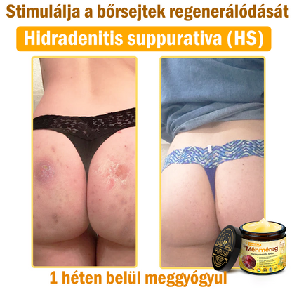 Utolsó nap! Már csak 5 tégely maradt a PUROSA® szuper kedvezményes ajánlatából! Most extra 50% kedvezménnyel teheted meg az első lépést a feszesebb és fiatalosabb bőr felé.