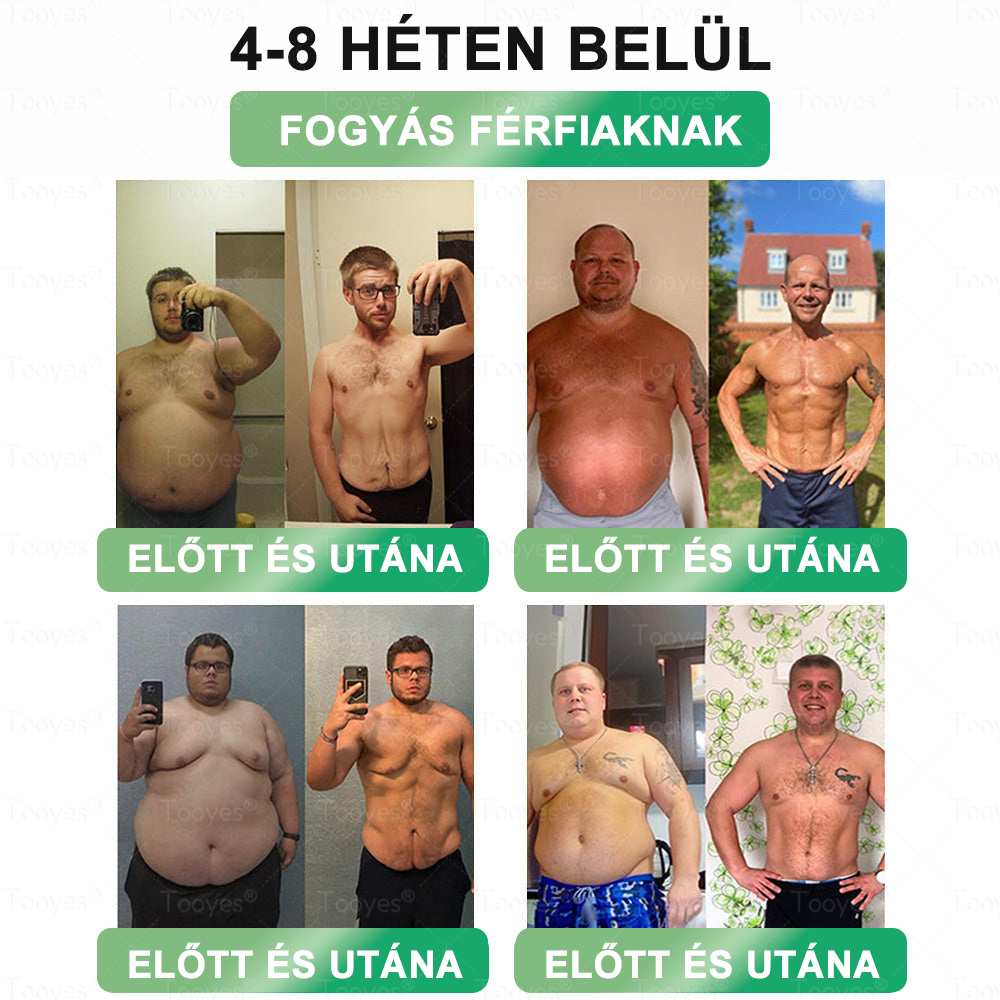 🏆Hivatalos áruház | CrazyLeaf® SMGT-GLP-1 nano tapasz kollagénnel & Matrixyl 3000-rel – Célzott hatás: elhízás,cukorbetegség,bőrmegereszkedés,  zsírmáj,  magas vérnyomás, energiaszint-csökkenés