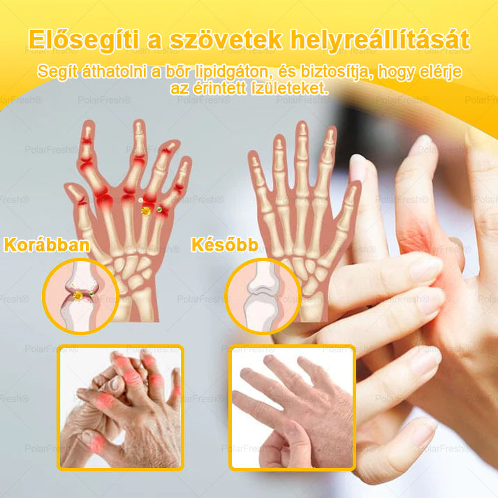 💧🎁 Már csak 5 doboz maradt! További 50%-os kedvezményt kínálunk! Szerezzétek vissza az alakotokat és egészségeteket. Most veszítsetek, és nem lesz több lehetőség jövő évig.