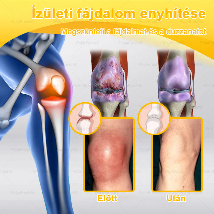 💧🐝PolarFresh® Magnézium Olaj & Méhméreg Fájdalomcsillapító, Csontregeneráló Krém 👨‍⚕️Jóváhagyta a Magyar Ortopéd Sebészek Akadémiája (Magyar Ortopédiai Sebésztársaság – MOSZT)