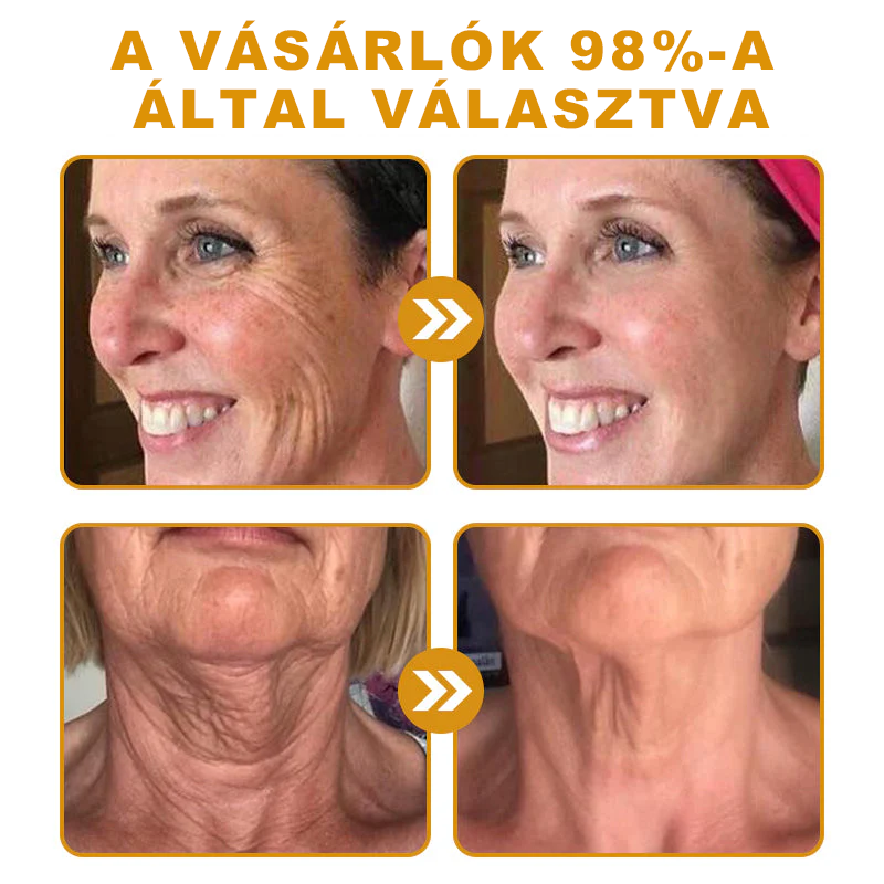 Utolsó nap! Már csak 5 tégely maradt a PUROSA® szuper kedvezményes ajánlatából! Most extra 50% kedvezménnyel teheted meg az első lépést a feszesebb és fiatalosabb bőr felé.