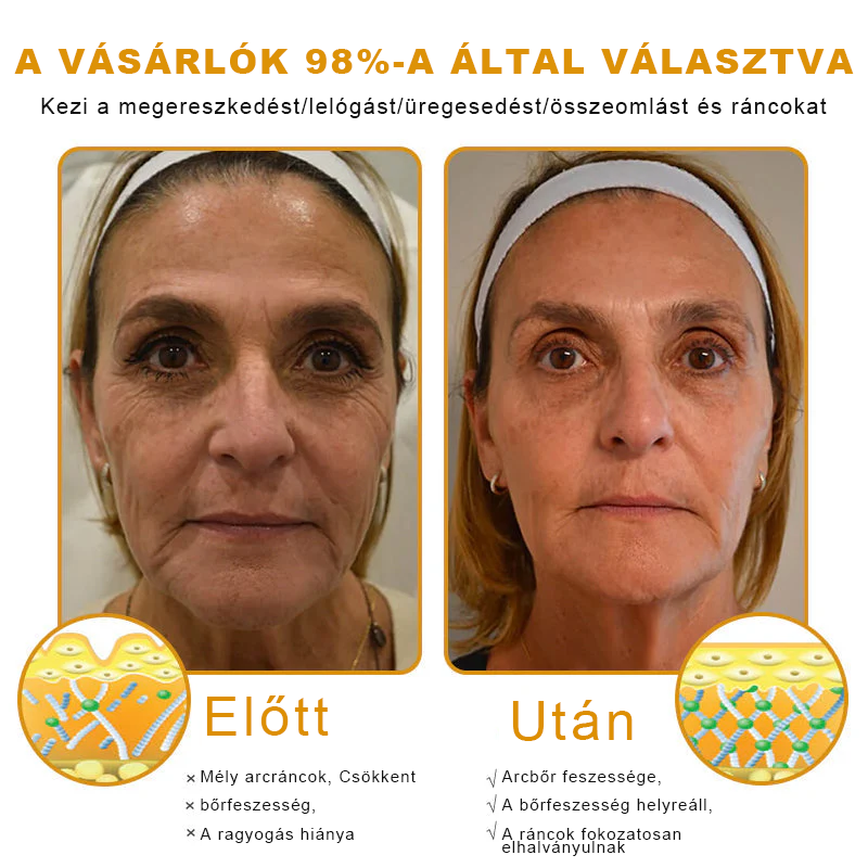 Utolsó nap! Már csak 5 tégely maradt a PUROSA® szuper kedvezményes ajánlatából! Most extra 50% kedvezménnyel teheted meg az első lépést a feszesebb és fiatalosabb bőr felé.